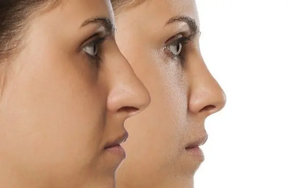Plastic Surgery Recovery: A Practical Guide to Healing and Aftercare Plastic Surgery Recovery